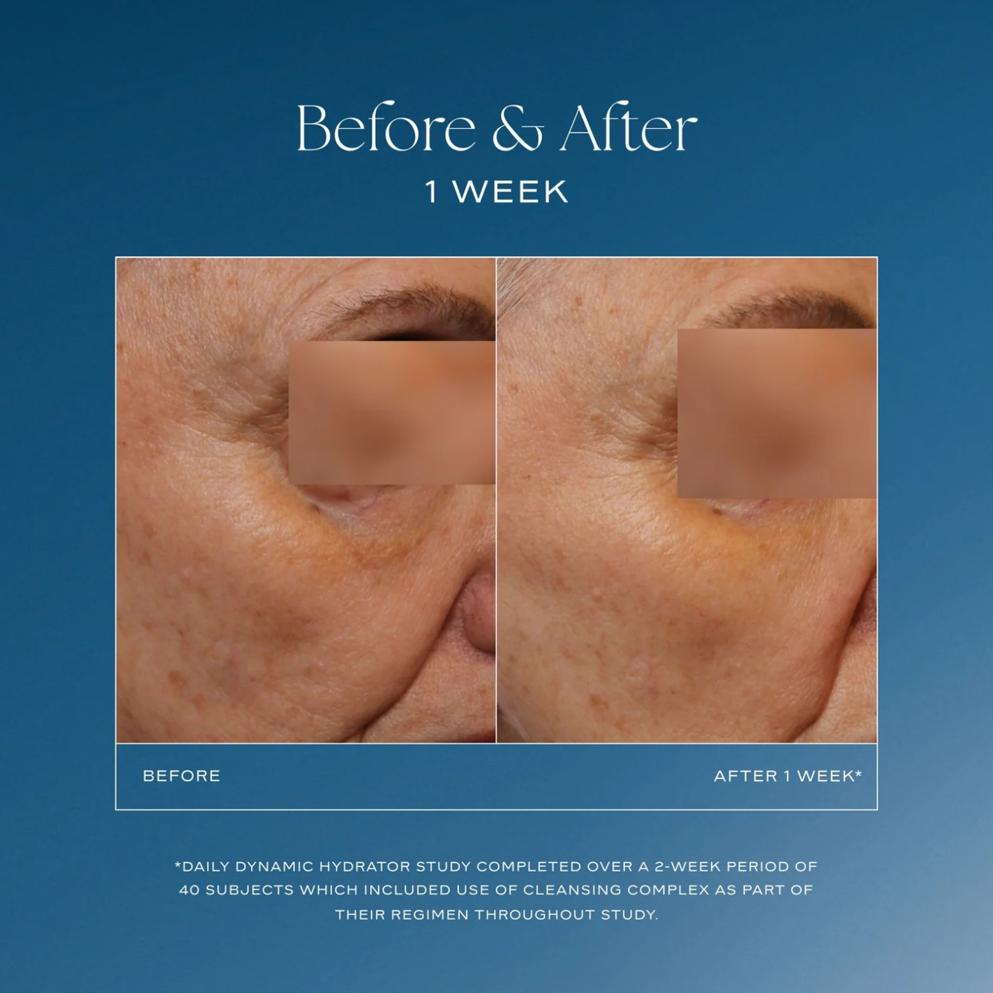 iS Clinical Daily Dynamic Hydrator Before and After